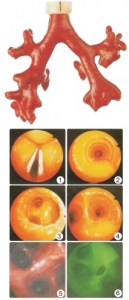“康為醫(yī)療”CLA9/8熒光氣管支氣管樹模型(消化內科技能模型）