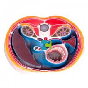 “康為醫(yī)療”腹腔橫斷模型