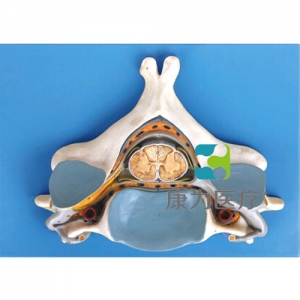 “康為醫(yī)療”第五頸椎附脊髓和脊神經放大模型