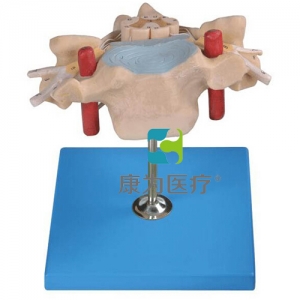 “康為醫(yī)療”頸椎附脊髓和脊神經放大模型